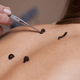 Illustration for article titled Best Leech Therapy Treatment In India
